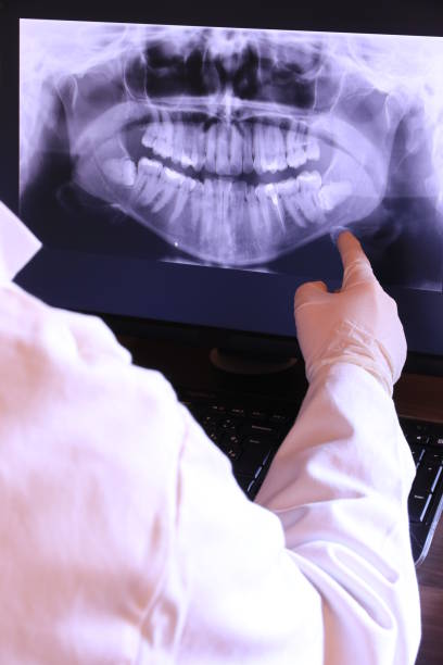Best Emergency Dentist for Knocked-Out Tooth in Keuka Park, NY