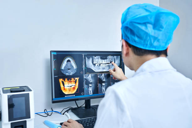 Best Emergency Dentist for Lost Fillings or Crowns in Keuka Park, NY